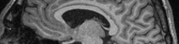 Dr. Jorge Alves (PhD) - Neuropsicologia Clínica: Cabeçalho - Imagens do Cérebro